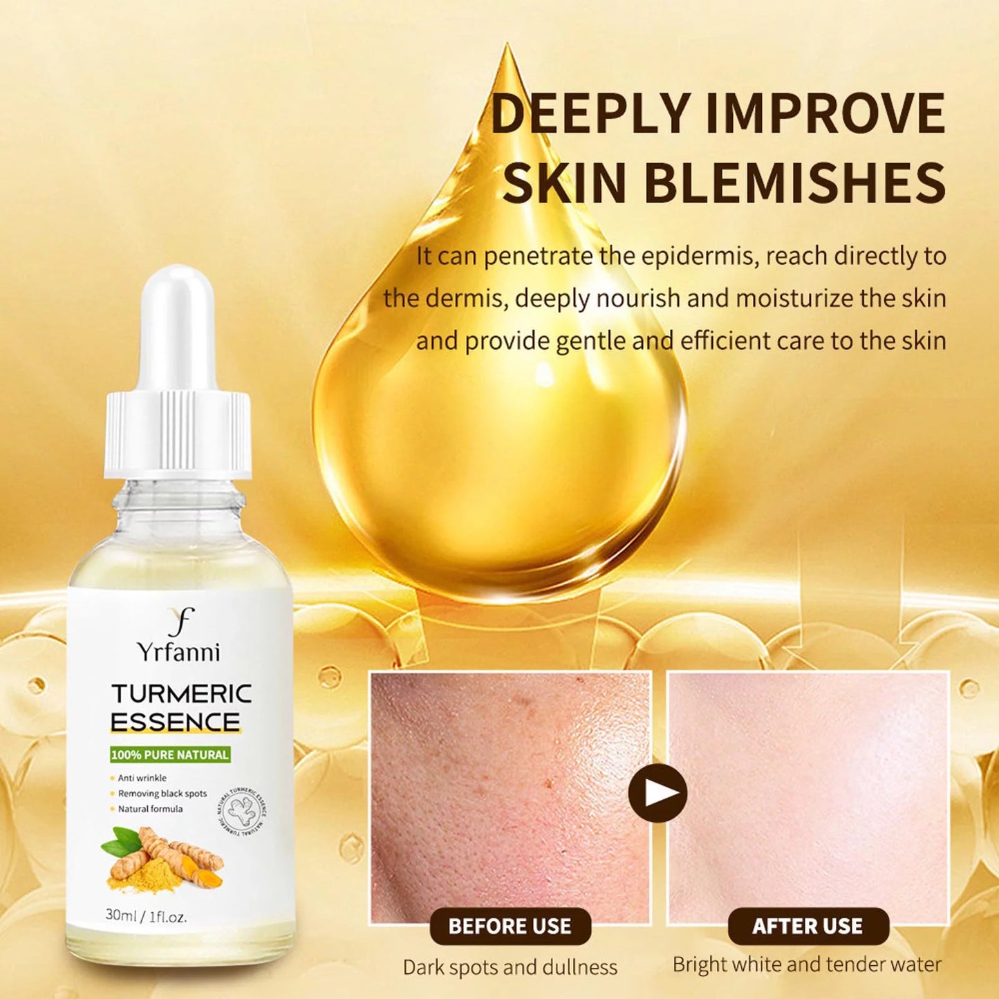 Turmeric Essence Can Mildly Moisturize the Face, Fade Fine Lines, and Whiten Aging Skin 30Ml Serum for Face Dark Spot Corrector Face Serum anti Aging