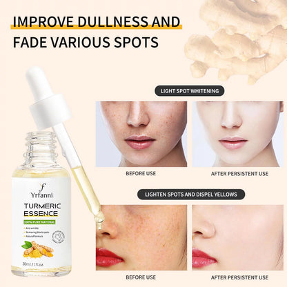 Turmeric Essence Can Mildly Moisturize the Face, Fade Fine Lines, and Whiten Aging Skin 30Ml Serum for Face Dark Spot Corrector Face Serum anti Aging