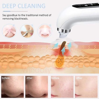 2024 Blackhead Remover Pore Vacuum Cleaner Electric Micro Small Bubble Facial Cleasing Machine USB Rechargeable Beauty Device