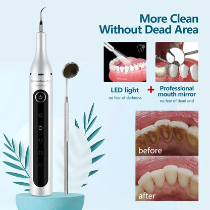 Ultrasonic Dental Scaler for Teeth Tartar Stain Tooth Calculus Remover